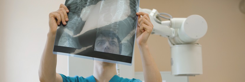 移動(dòng)CR放射衛(wèi)生檢測(cè)評(píng)價(jià)